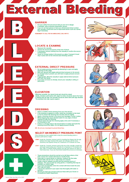 External Bleeding